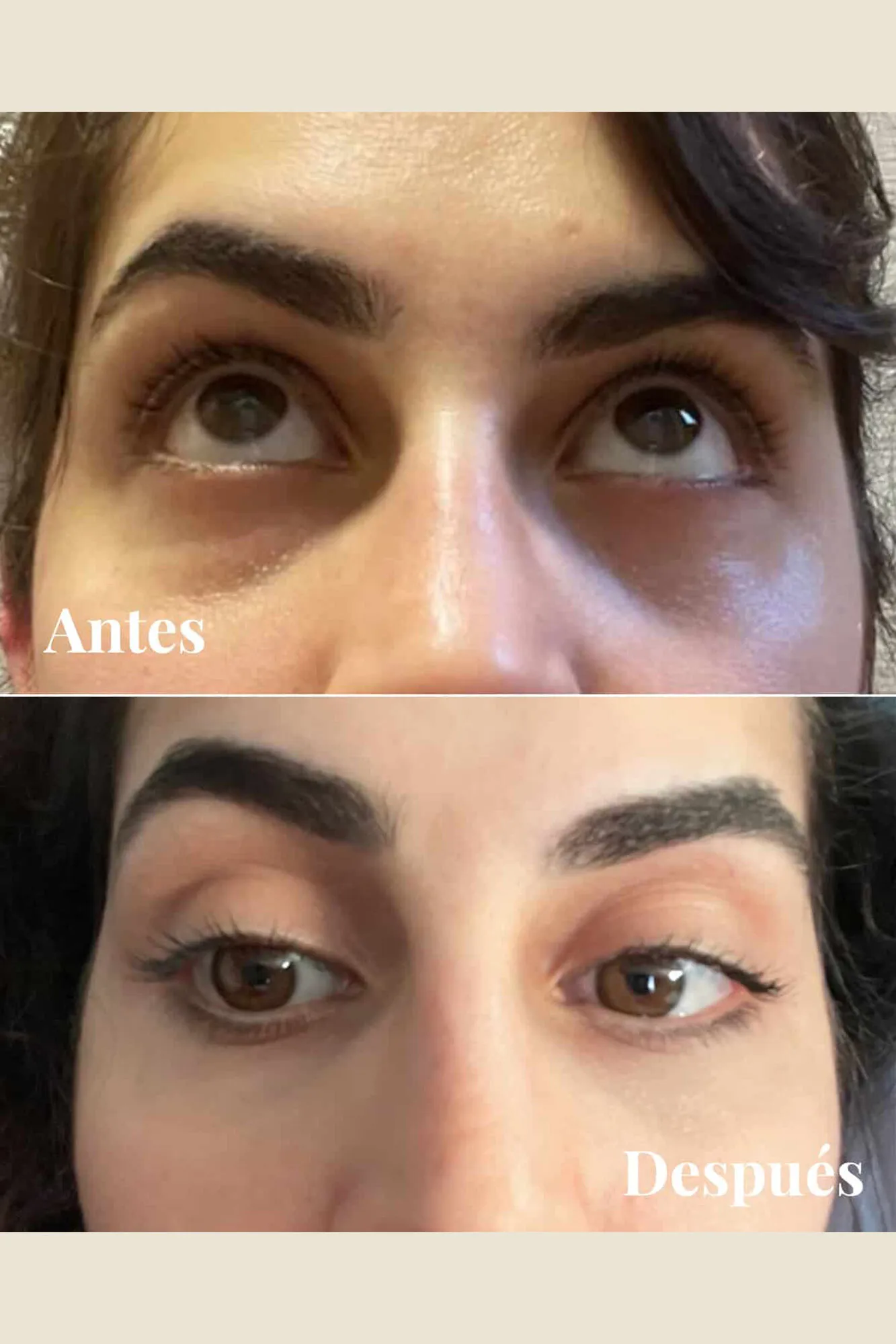 Contorno de ojos revitalizador